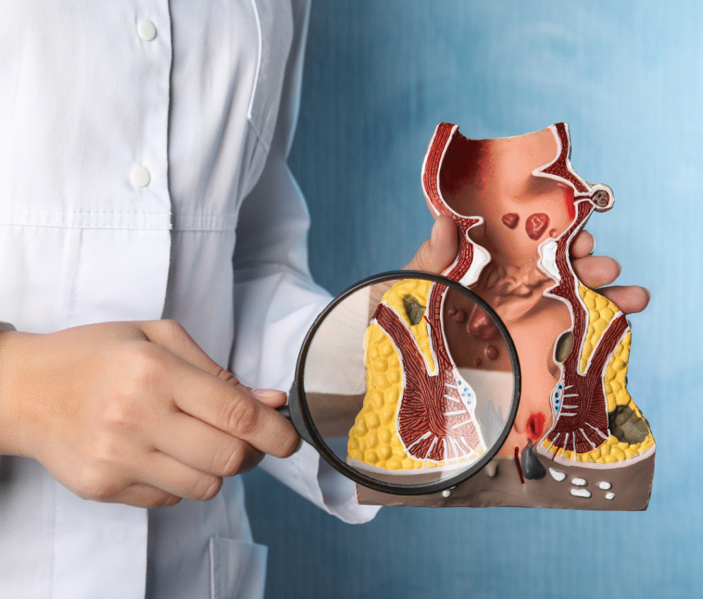 בדיקת קולונוסקופיה